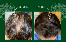Load image into Gallery viewer, Herbal Infused Biotin Scalp Therapy
