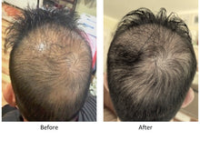 Load image into Gallery viewer, Herbal Infused Liposomal Biotin Scalp Therapy (Heemal Herbal HairGro Spray)
